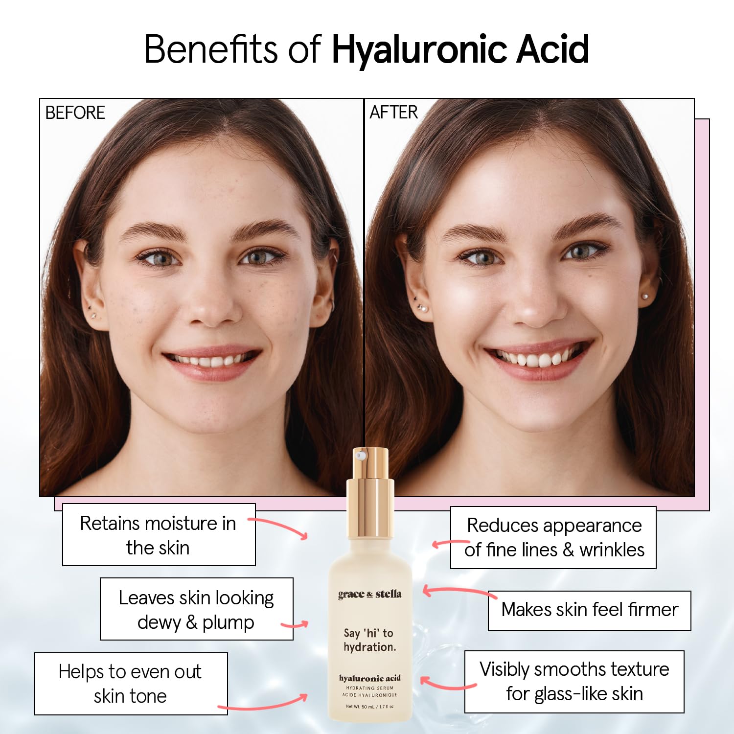 grace & stella  Hyaluronic Acid Serum (50ml) - Vegan -  Acido Hialuronico to Hydrate and Remove Fine Lines + Wrinkles, Boost Collagen - - canavitam