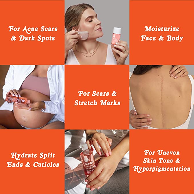 Bio-Oil Skincare Oil -  260 mL - canavitam