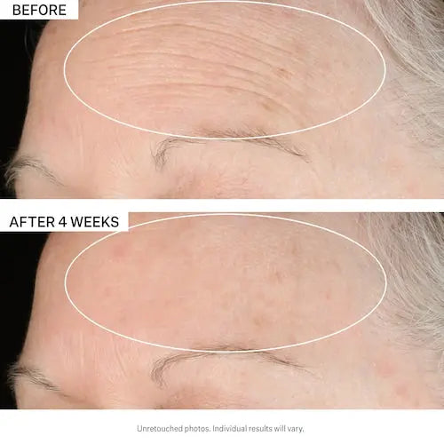 Strivectin SD Advanced PLUS Intensive Moisturizing Concentrate - canavitam