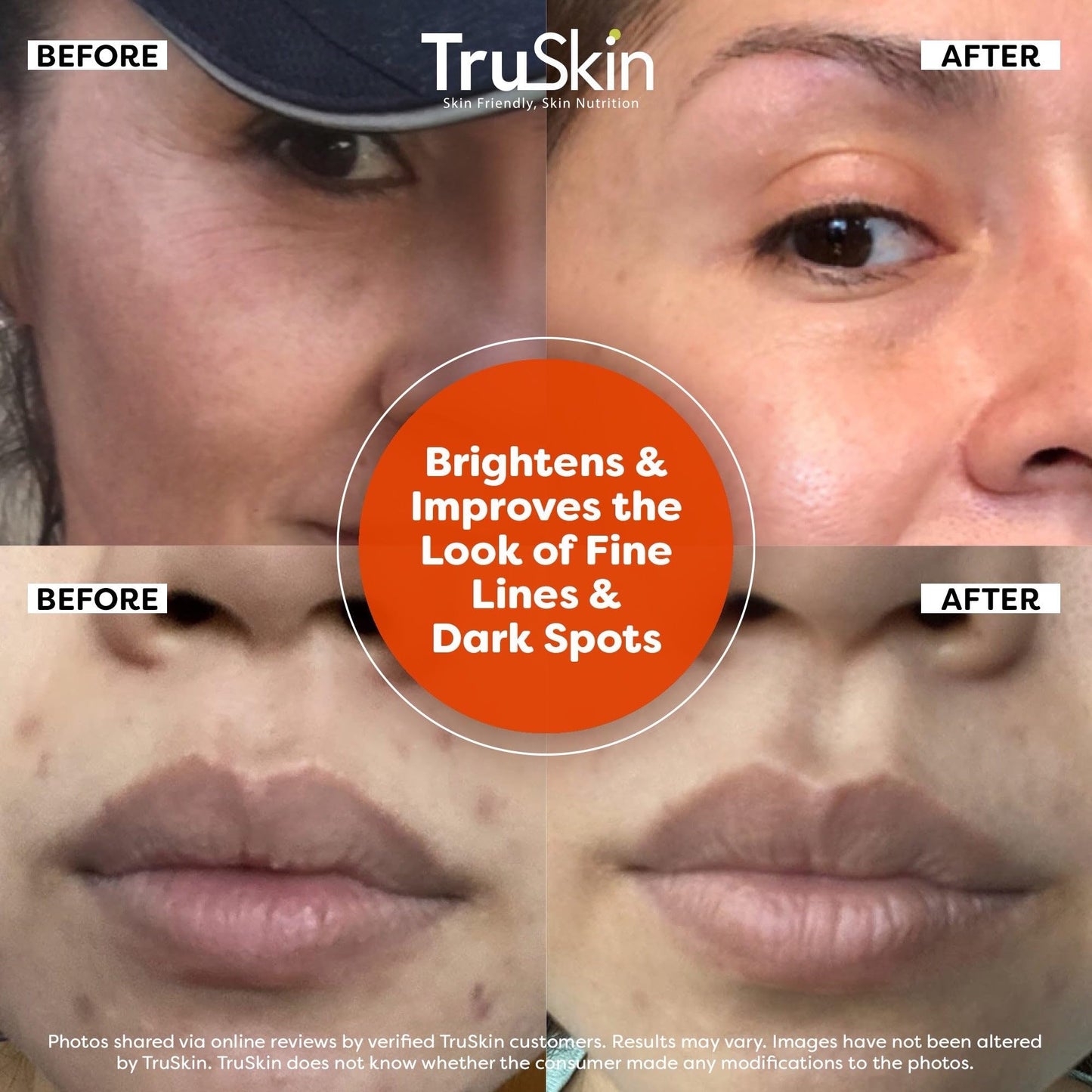 TruSkin Vitamin C Serum for Face – Anti-Aging Brightening Serum with Hyaluronic Acid & Vitamin E – Fade Dark Spots, Even Skin Tone, Reduce Fine Lines & Wrinkles – 2 Fl Oz